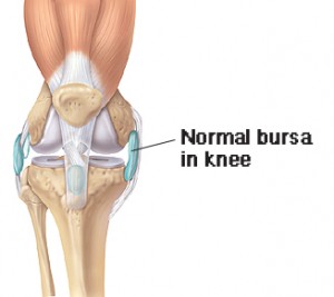 Bursitis Knee Treatment