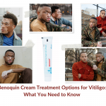Benoquin Cream Treatment Options for Vitiligo: What You Need to Know